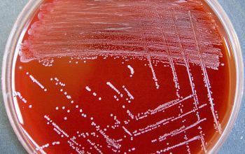 Pediococcus Acidilactici Blood Sugar