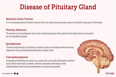 Pituitary Gland Disorders In Adults