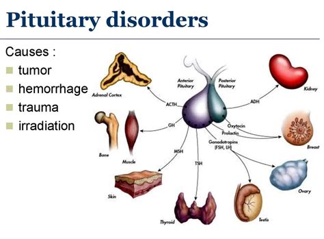 Pituitary Gland Disorders In Child