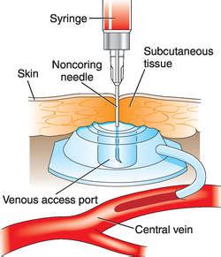 Port Health Meaning