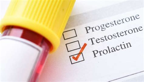 Prolactin Blood Test Results