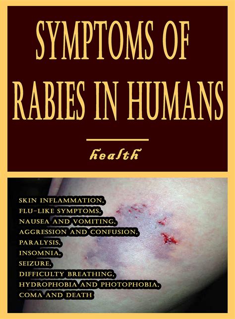 Rabies