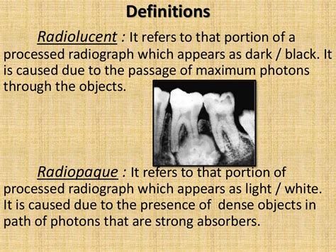 Radiolucency Dental Meaning