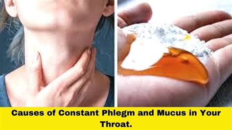 Reasons For Mucus In Throat