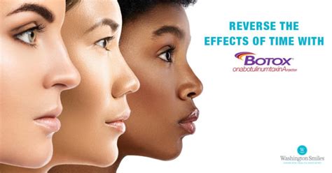 Reverse The Effects Of Time With Botox Washington Smiles Complete Health Dentistry