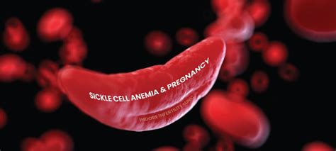 Sickle Cell Anaemia Fertility Pregnancy