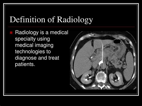 Simple Healthcare Definition Of Radiolucent