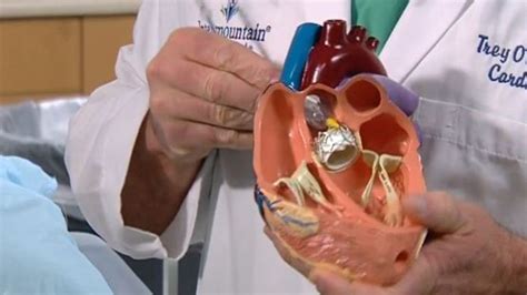 Tavr Surgery Near Me