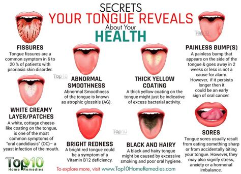 Top 5 Tips To Maintain Your Tongue Health Dentique Cochin