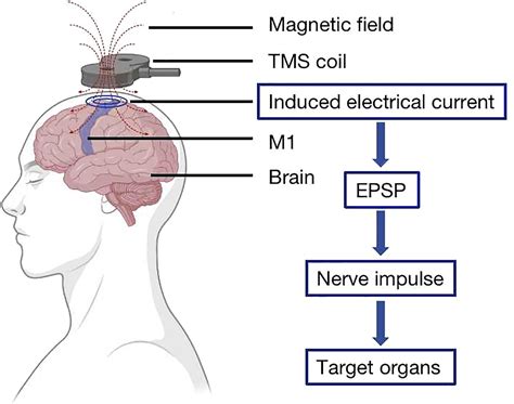 Transcranial Magnetic Stimulation Hawaii