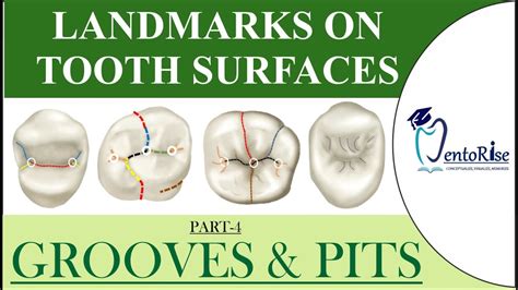 Types Of Grooves In Teeth