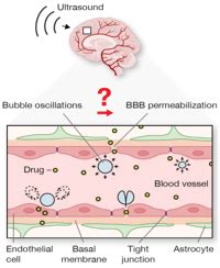 Ultrasound Frequency Controlled Microbubble Dynamics In Brain Vessels Regulate The Enrichment Of Inflammatory Pathways In The Blood Brain Barrier Nature Communications