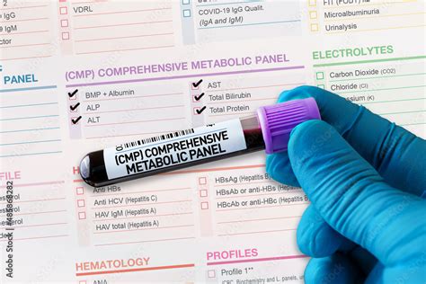 Wellness Panel Blood Test