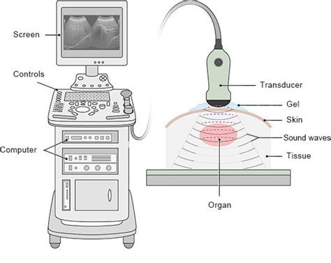 What Are Ultrasound People Called