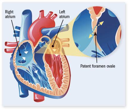 What Is A Bubble Study Harvard Health