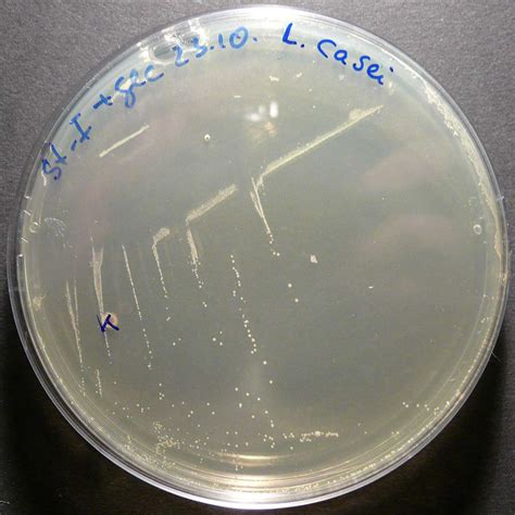 What Is Lacticaseibacillus Casei