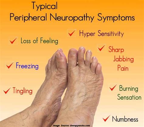 What Is Neuropathy Nerve Damage Symptoms Causes Treatment