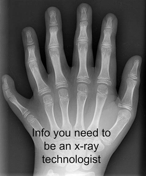 What You Need To Know If You Want To Be An X Ray Tech Hubpages