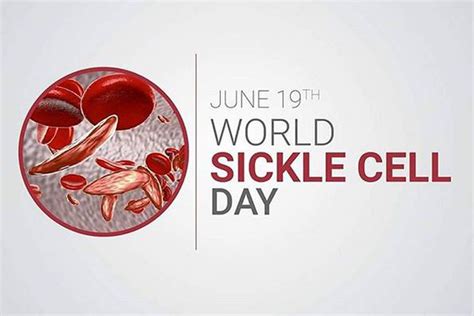 World Sickle Cell Day All You Need To Know About The Sickle Cell